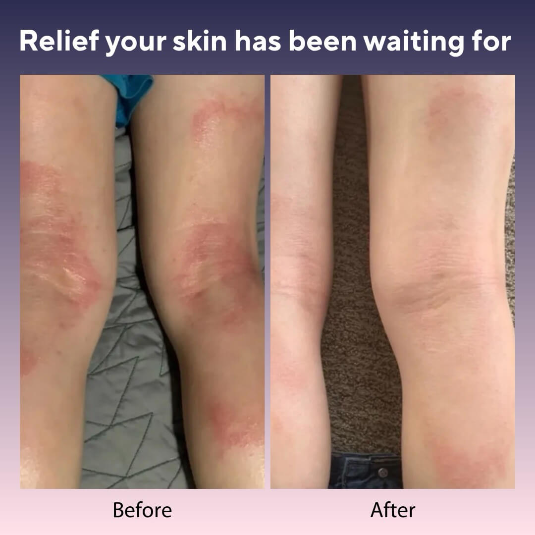 Skin Relief Tallow Balm