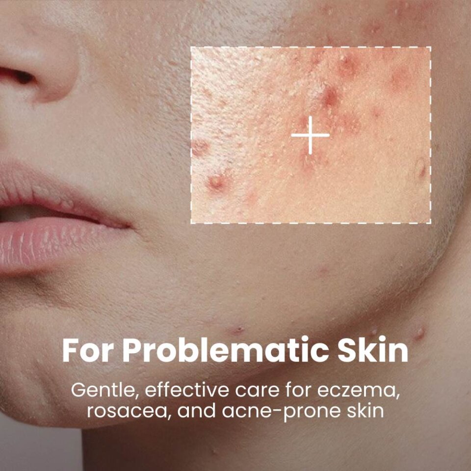 Skin Relief Tallow Balm