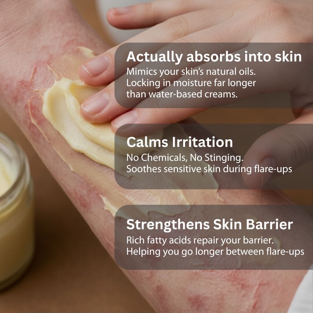 Skin Relief Tallow Balm