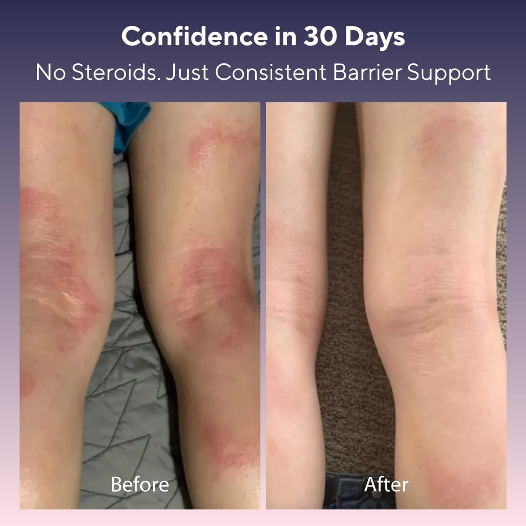 Skin Barrier Restore Cream (200ml)