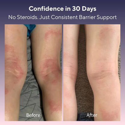 Skin Barrier Restore Cream (200ml)