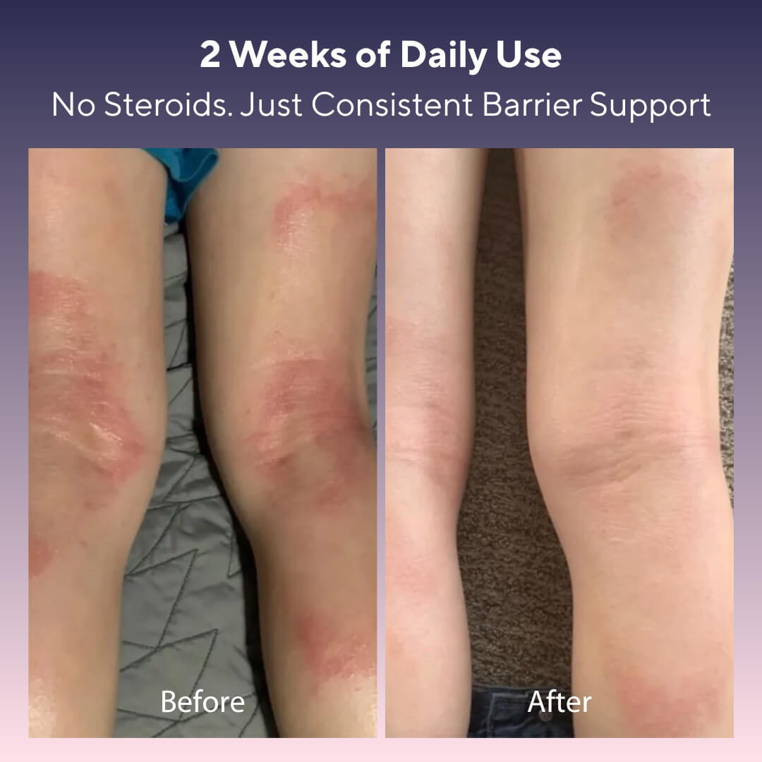 Skin Relief Tallow Balm