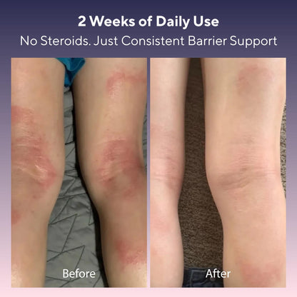 Skin Relief Tallow Balm