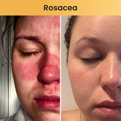 Skin Relief Tallow Balm