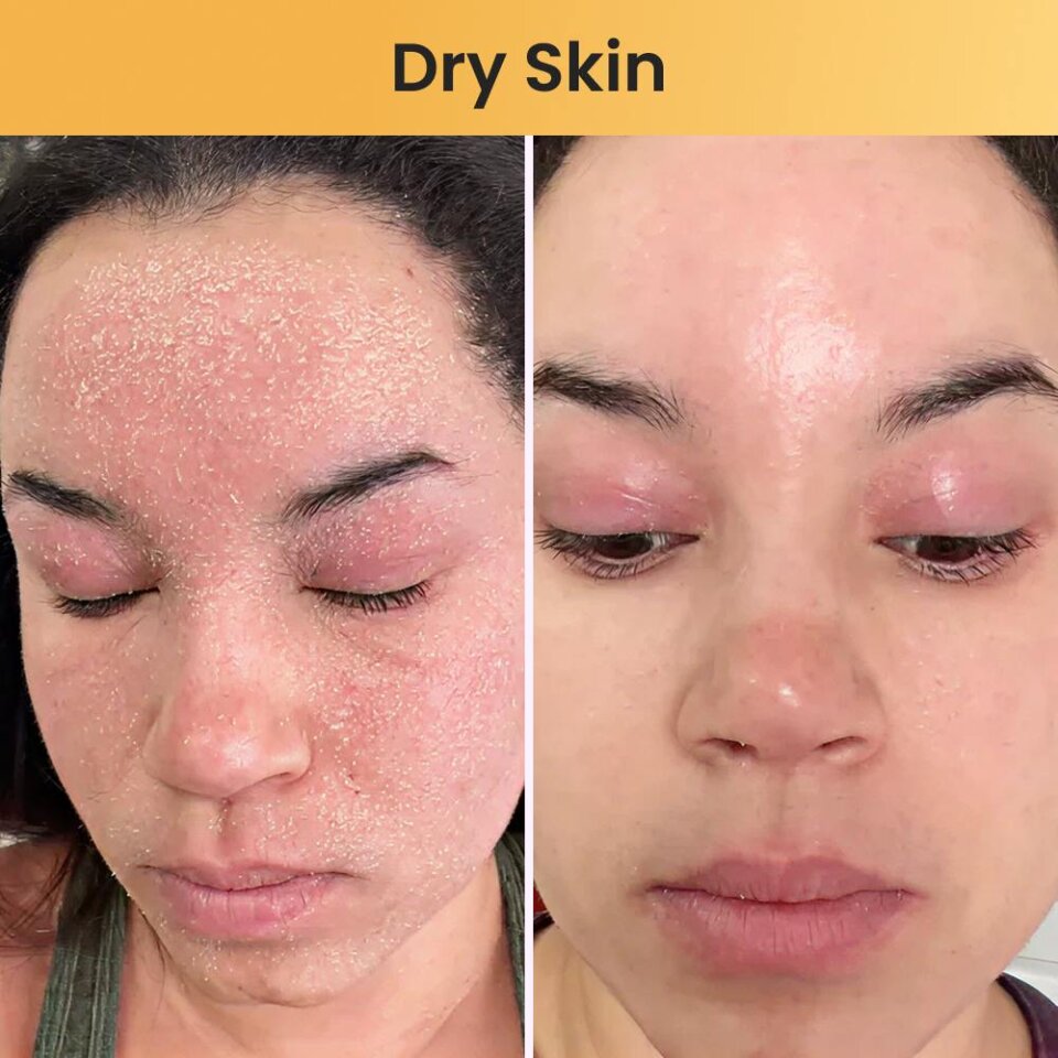 Skin Relief Tallow Balm