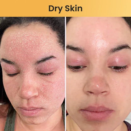 Skin Relief Tallow Balm