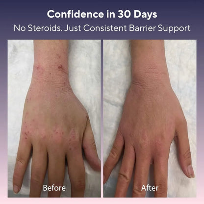 Skin Barrier Restore Cream (200ml)