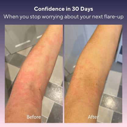 Skin Relief Tallow Balm